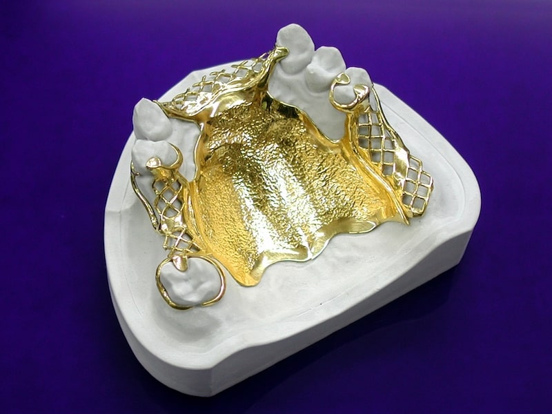 金属床の義歯